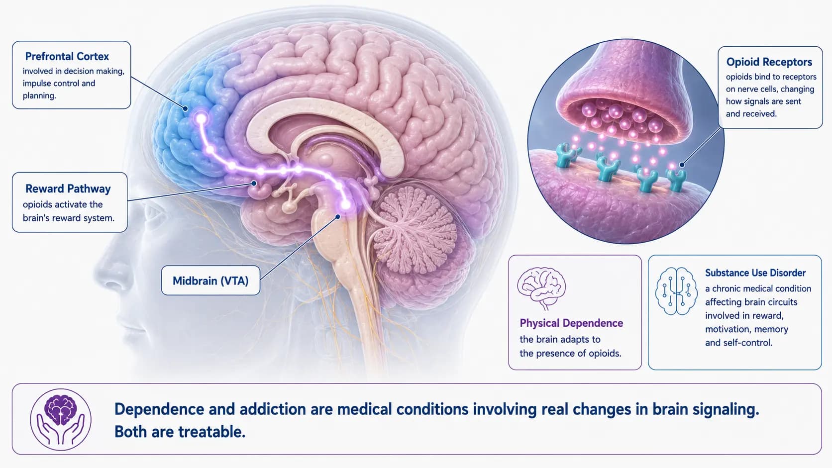 Opioid Addiction and Substance Use anatomy illustration